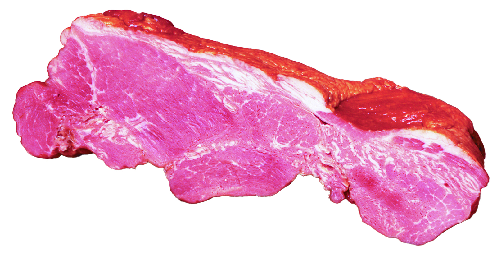 shoulder-bacon